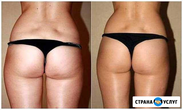 Массаж Набережные Челны - изображение 1