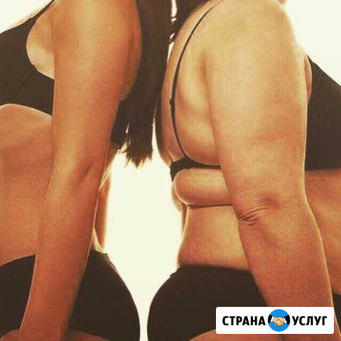 Антицеллюлитный массаж Санкт-Петербург - изображение 1