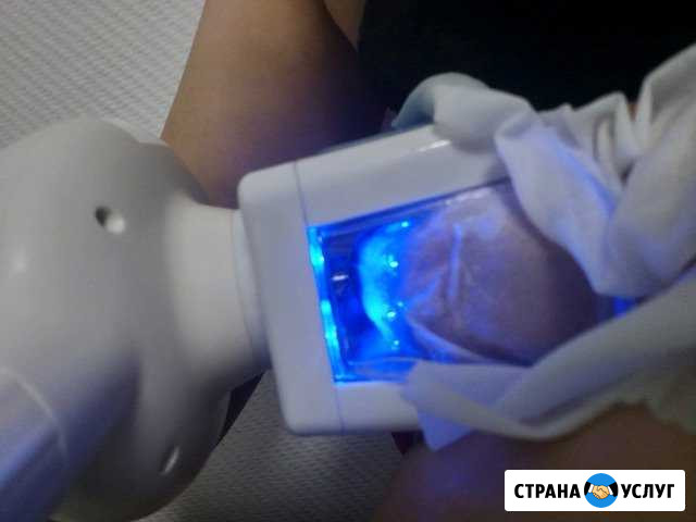 Криолиполиз Ачинск - изображение 1