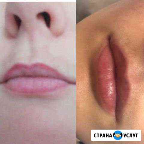 Лазерное удаление тату и татуажа Санкт-Петербург