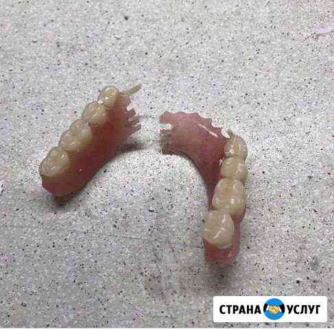 Ремонт съемных протезов Махачкала