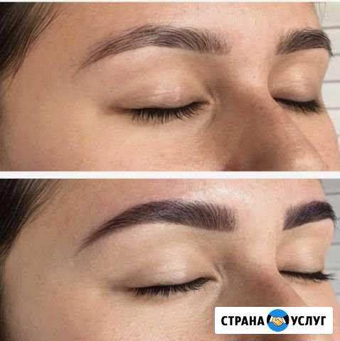 Архитектура коррекция бровей Москва - изображение 1