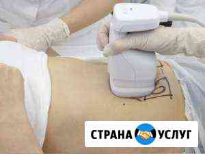 Липосоникс(липосакция лица и тела) Анапа