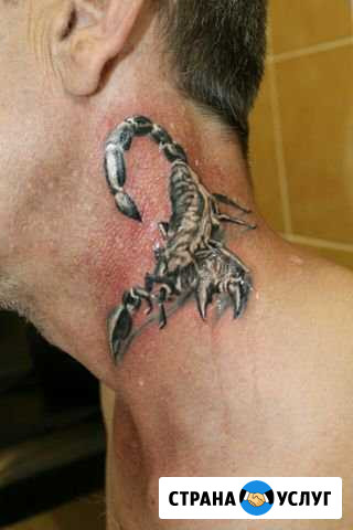 Tattoo scar Кострома - изображение 1