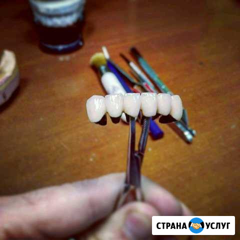 Услуги зубного техника Махачкала - изображение 1