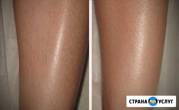 Шугаринг Верхняя Салда - изображение 1