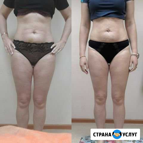 Все виды массажа Златоуст - изображение 1