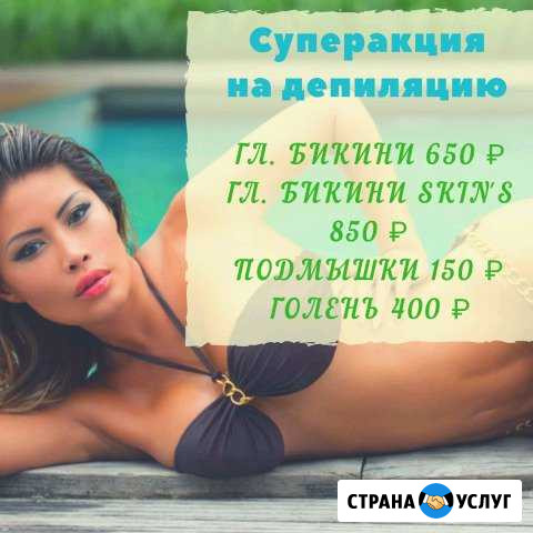 Депиляция мужская и женская Череповец - изображение 1