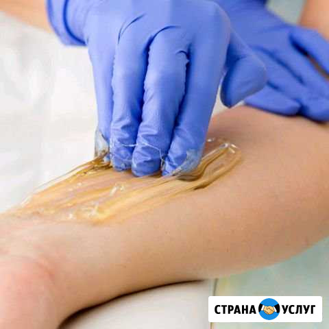 Шугаринг Смоленск - изображение 1