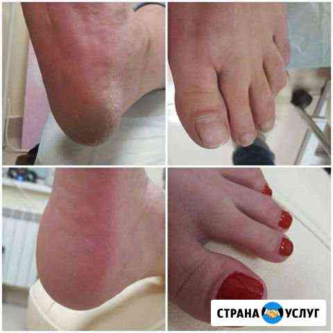 Шеллак наращивание педикюр Махачкала