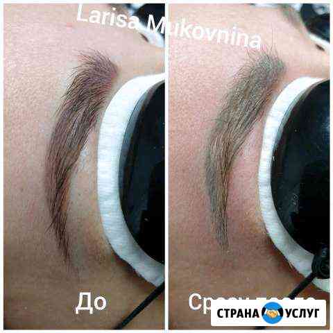 Лазерное удаление некачественного татуажа или тату Красногорск