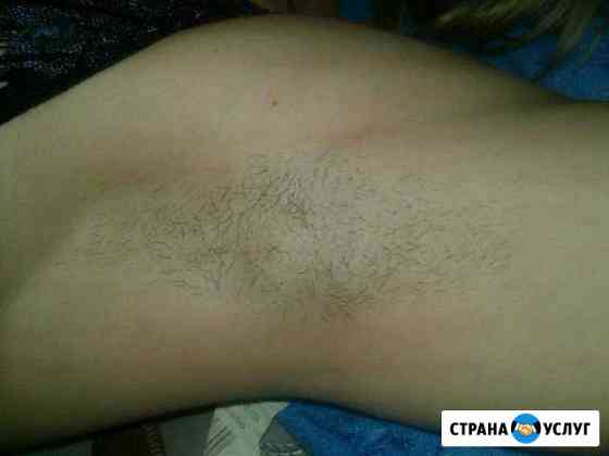 Шугаринг,корекция фигуры Невинномысск