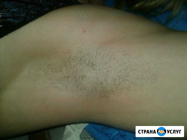 Шугаринг,корекция фигуры Невинномысск - изображение 1