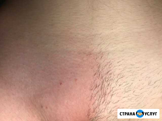 Шугаринг проф мастером Тамбов - изображение 1