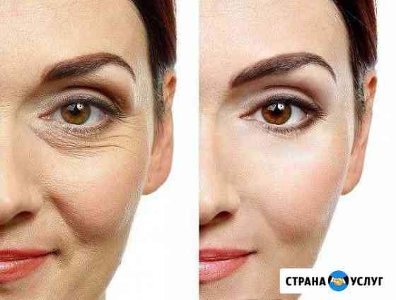 Фейсбилдинг Байкит