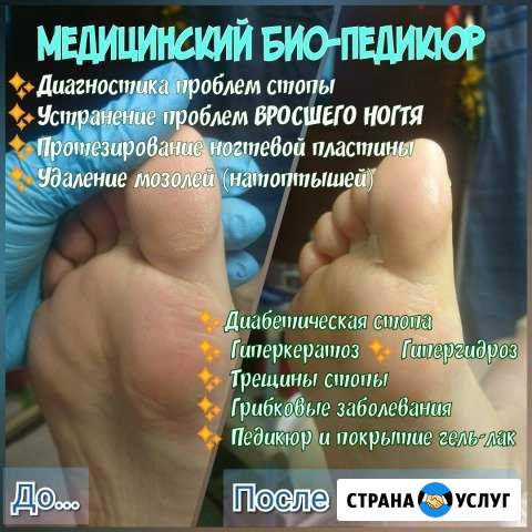 Парамедицинский, Ферментативный педикюр Маркс - изображение 1