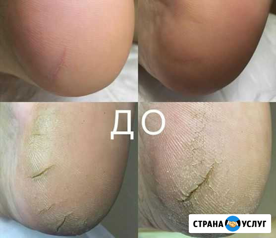 Педикюр гель-лак наращивание ногтей Котлас - изображение 1