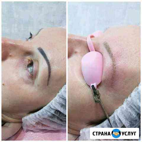 Лазерное удаление татуажа и татуировок Анапа