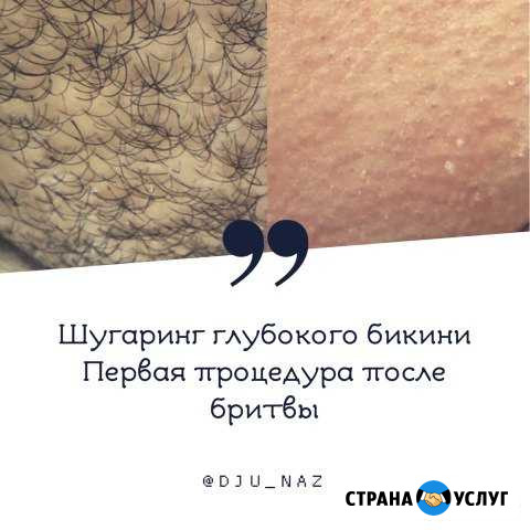 Шугаринг/Электроэпиляция Владикавказ - изображение 1
