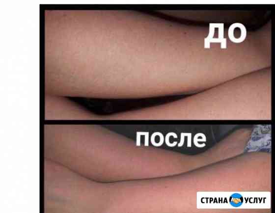 Шугаринг в самом центре Одинцово Одинцово