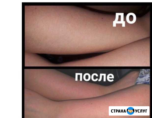 Шугаринг в самом центре Одинцово Одинцово - изображение 1