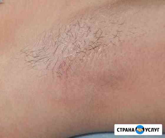 Депиляция Березники