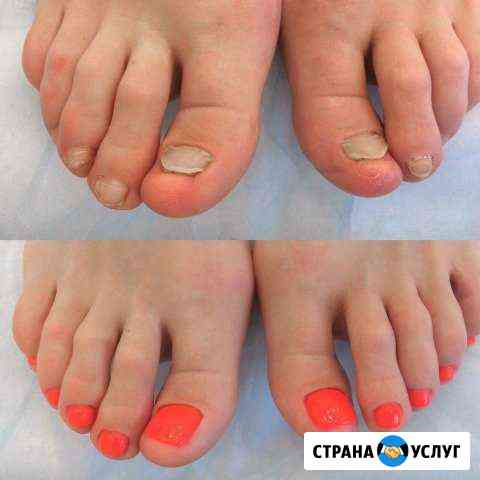 Педикюр, маникюр Свободный