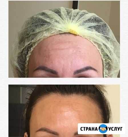 Моделирование лица Астрахань - изображение 1