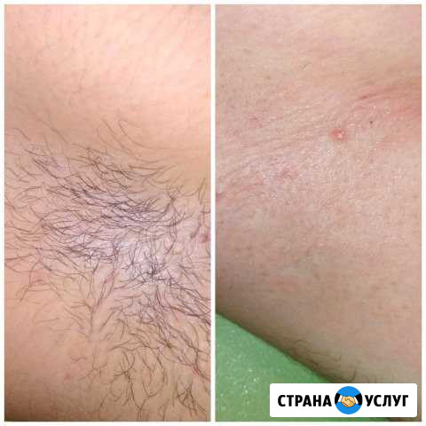 Шугаринг женский и мужской Волжский Волгоградской области - изображение 1