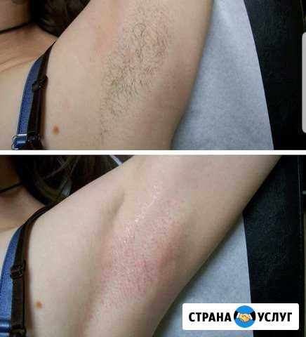 Восковая депиляция Новороссийск - изображение 1