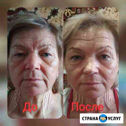 Массаж лица, антицеллюлитный массаж Киров