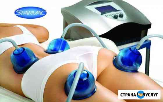 Старвак Иркутск