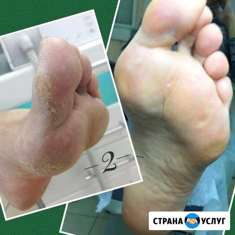 Педикюр Нягань - изображение 1