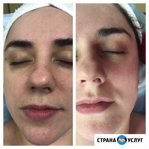 Косметолог Одинцово - изображение 1
