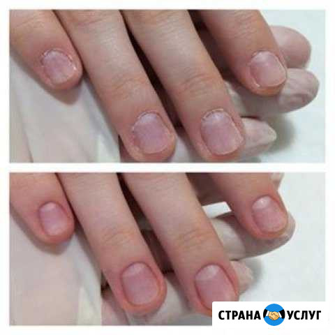 Аппаратный маникюр, обучение Брюховецкая - изображение 1