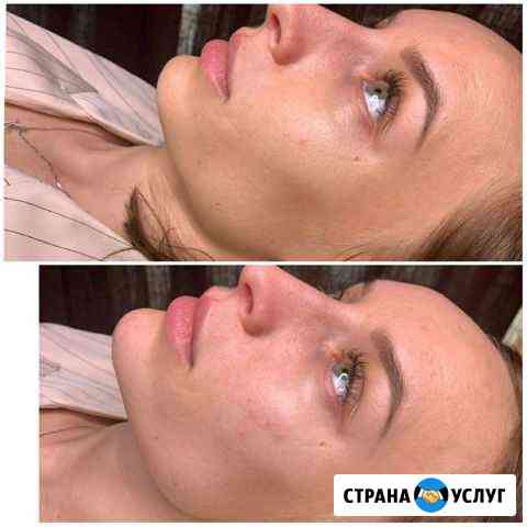 Косметолог Сергиев Посад