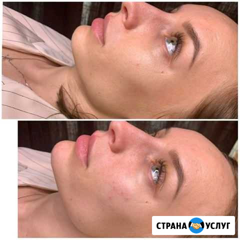 Косметолог Сергиев Посад - изображение 1