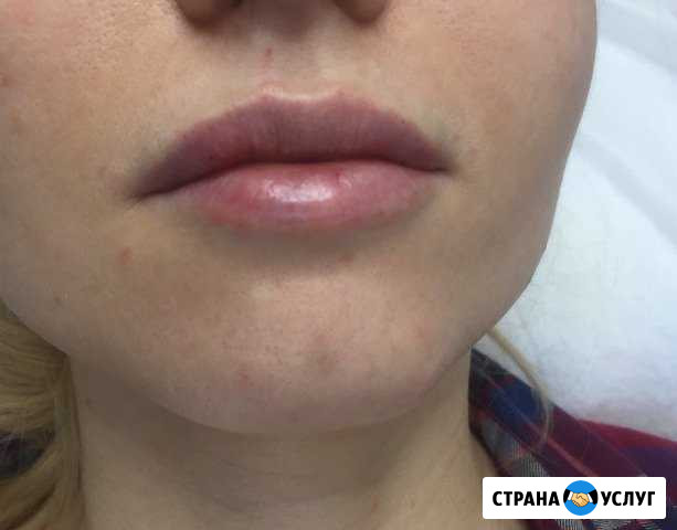 Косметолог Одинцово - изображение 1
