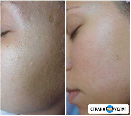 Ультрозвуковая чистка Севастополь - изображение 1