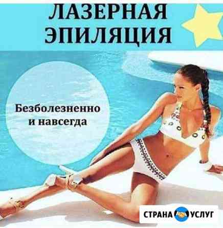Лазерная эпиляция Назарово