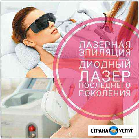 Лазерная эпиляция Мытищи