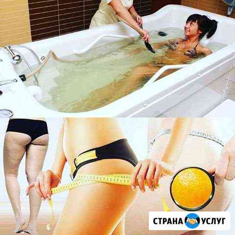 Коррекция фигуры Сургут
