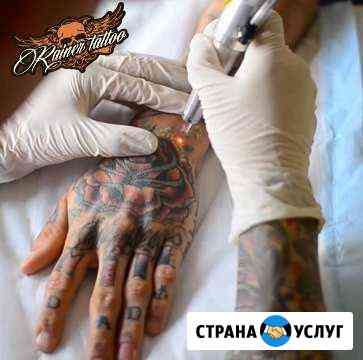 Удаление татуировок в Белгороде Белгород