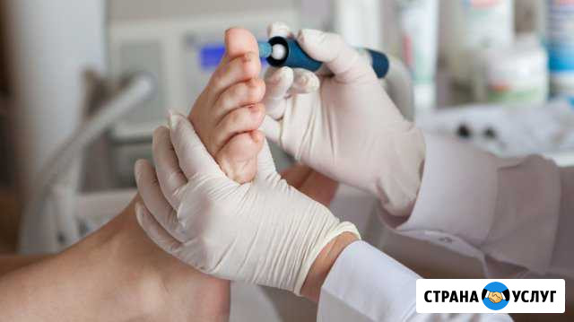 Медицинский педикюр на дому Санкт-Петербург - изображение 1