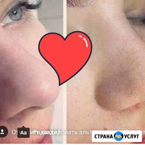 Чистка лица Грозный - изображение 1