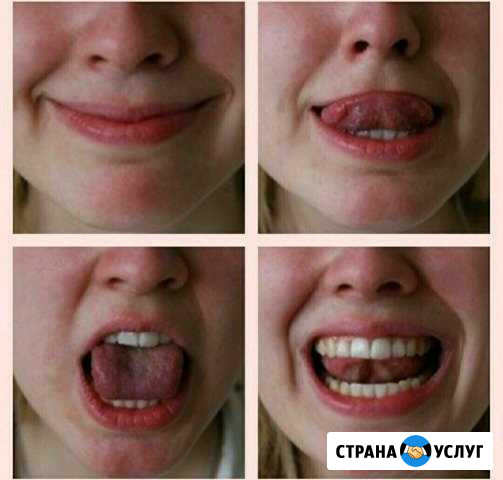 Логопед Ростов-на-Дону - изображение 1