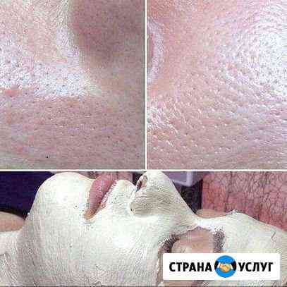 Косметолог Ессентуки
