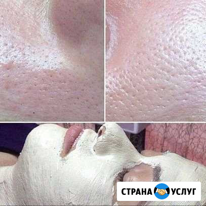 Косметолог Ессентуки - изображение 1