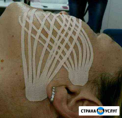 Эстетическое тейпирование лица Ижевск