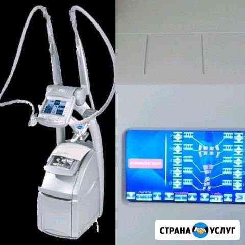 LPG массаж/коррекция фигуры Санкт-Петербург